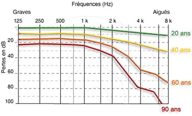 Graphique de la presbyacousie selon les fréquences